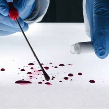 Forensic Science Series II - Blood Evidence